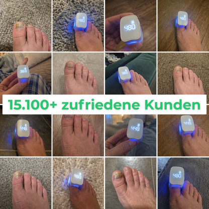 Levora - MedNail gegen jahrelangen Nagelpilz